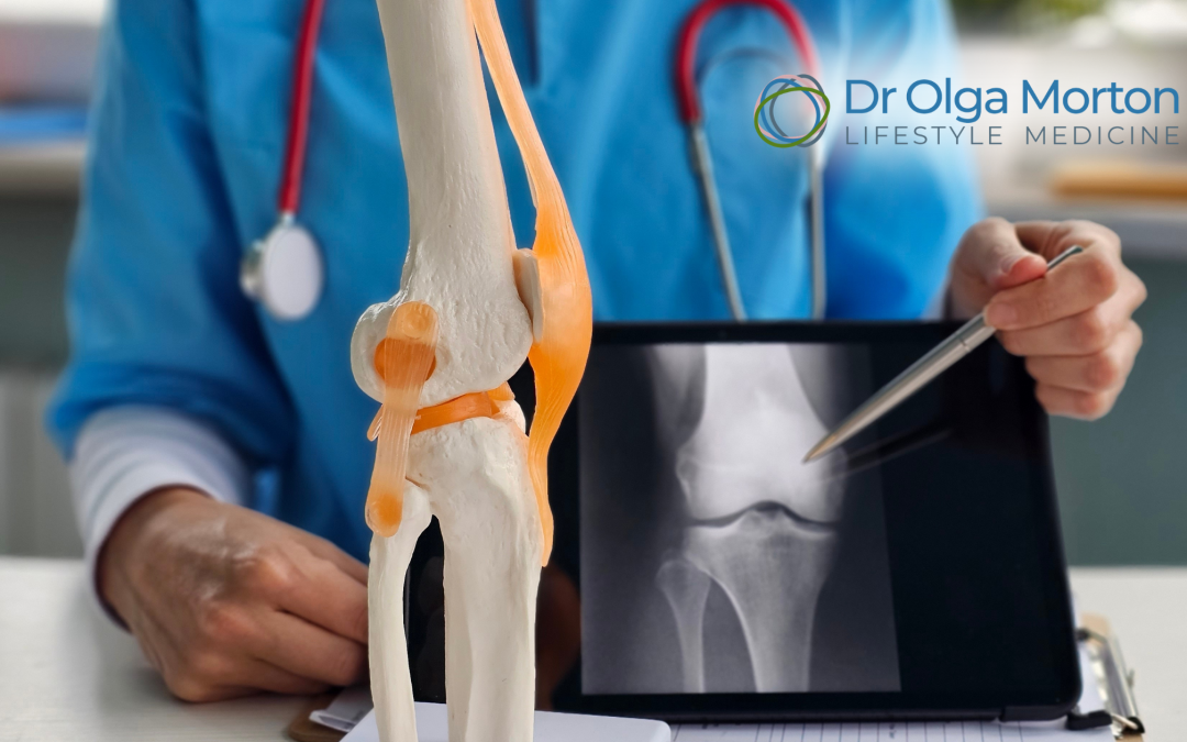 Is HRT the Answer to Preventing Osteoporosis? 🦴